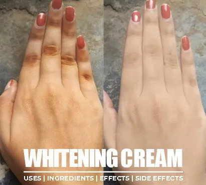 27790 exogenous ochronosis