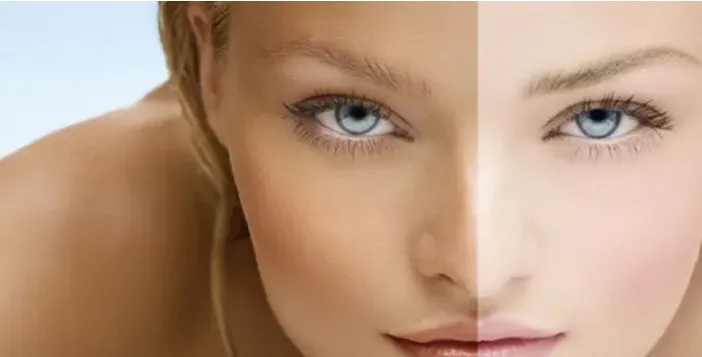 27803 deep whitening checkup