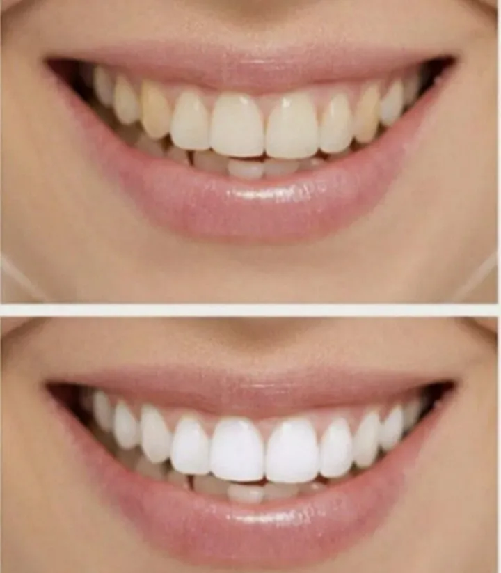 /img/27820-dentiste-whitening-toothpaste-where-to-buy.webp