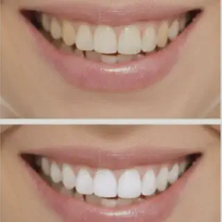/img/27820-dentiste-whitening-toothpaste-where-to-buy.webp