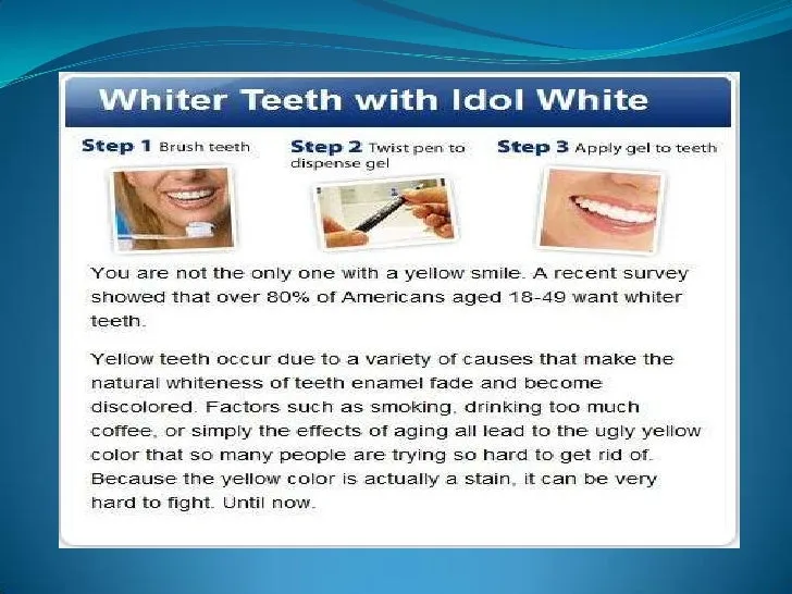 27825 in office teeth whitening