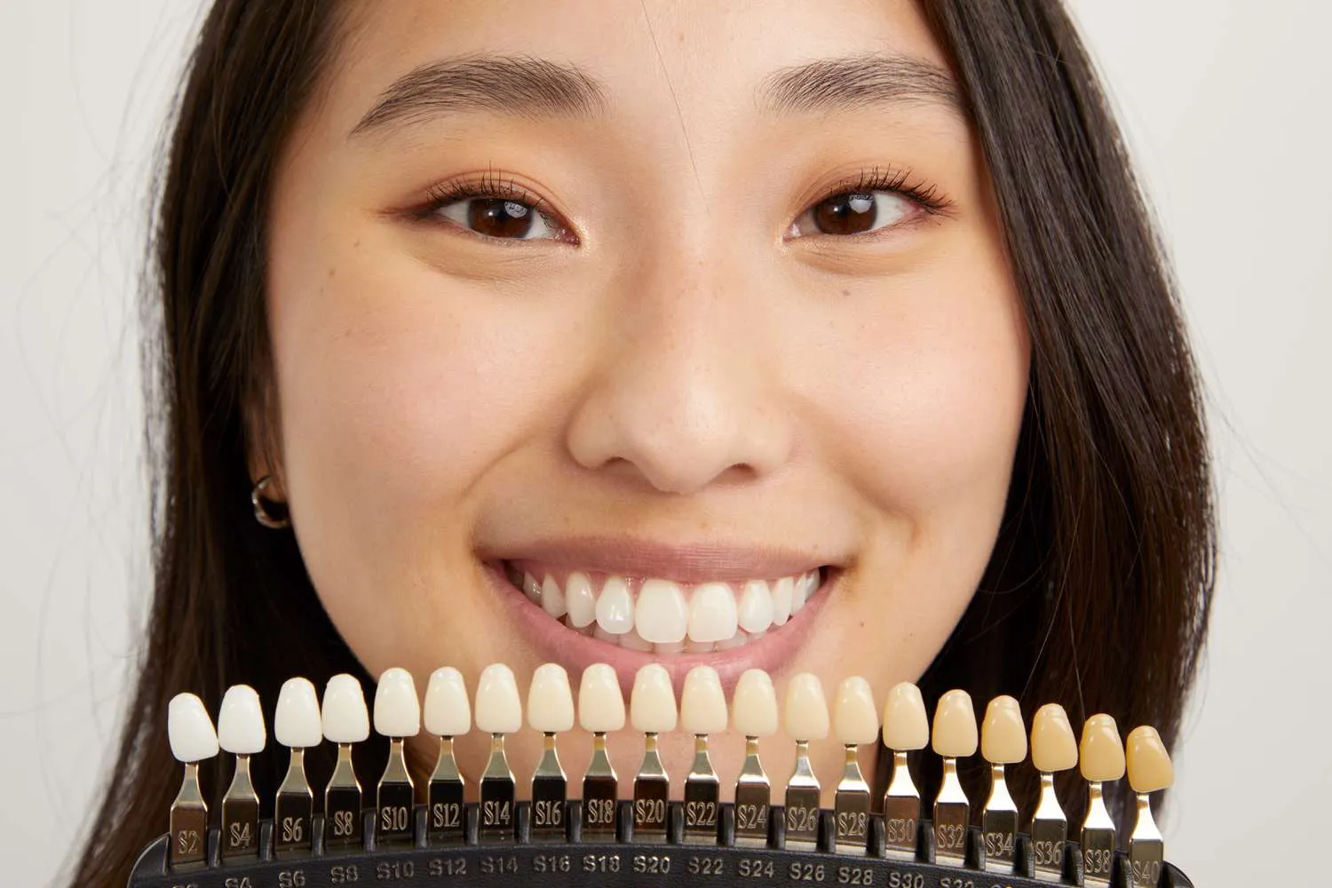 27825 teeth whitening before after