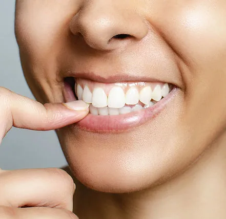 27831 dead tooth uk image6