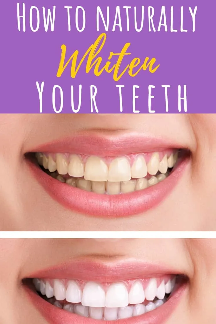 /img/27834-professional-teeth-whitening.webp