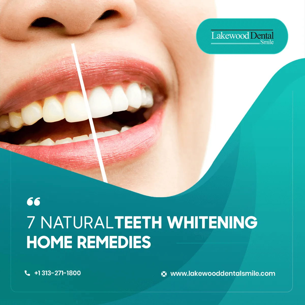 27834 teeth whitening tips