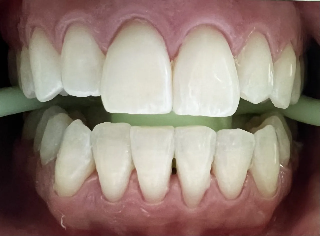 27835 healthy smile diet