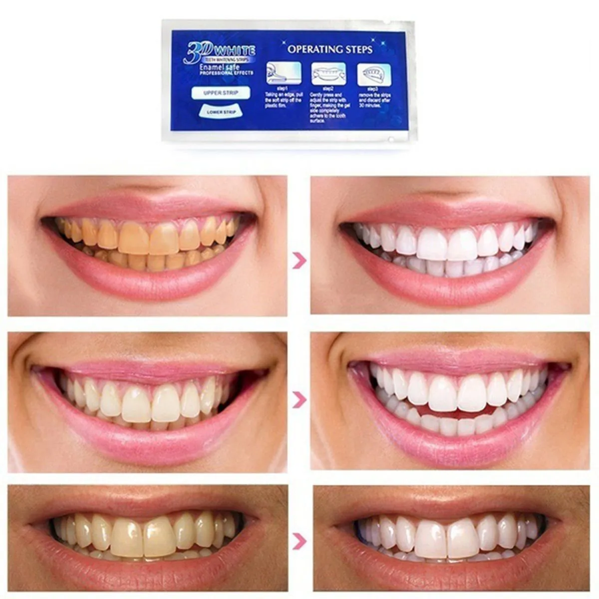 27843 teeth whitening 3d strips 7