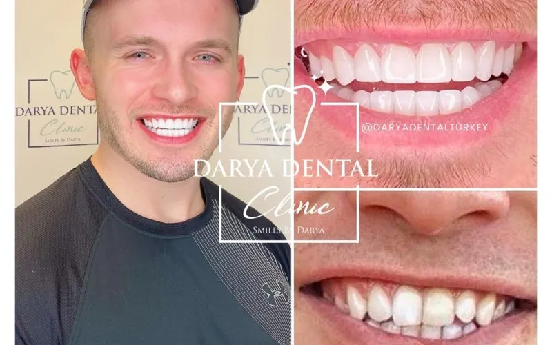 27847 baking soda peroxide