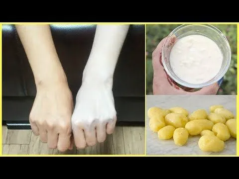 27848 boiled potato face whitening 4