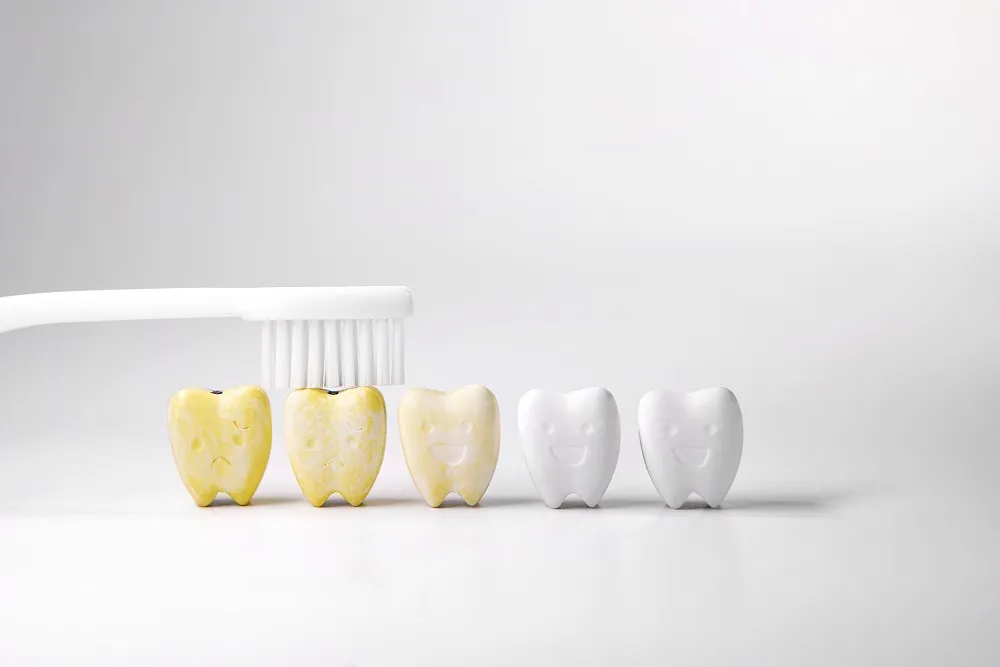 27859 yellow teeth after whitening 6