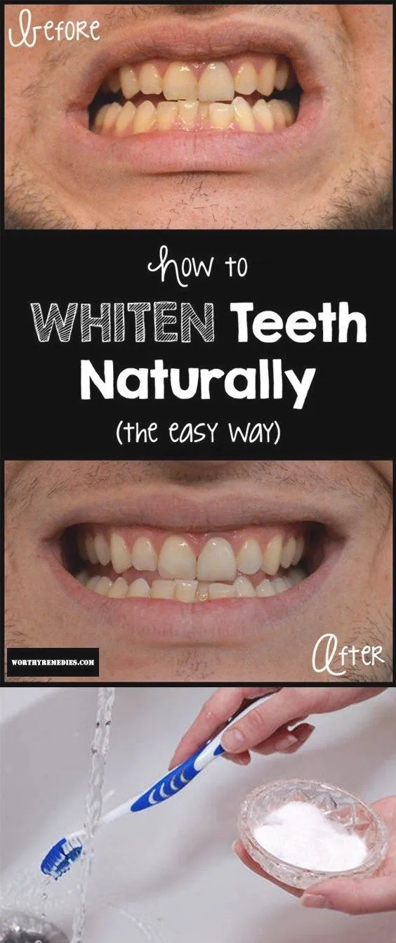 27870 toothpaste selection