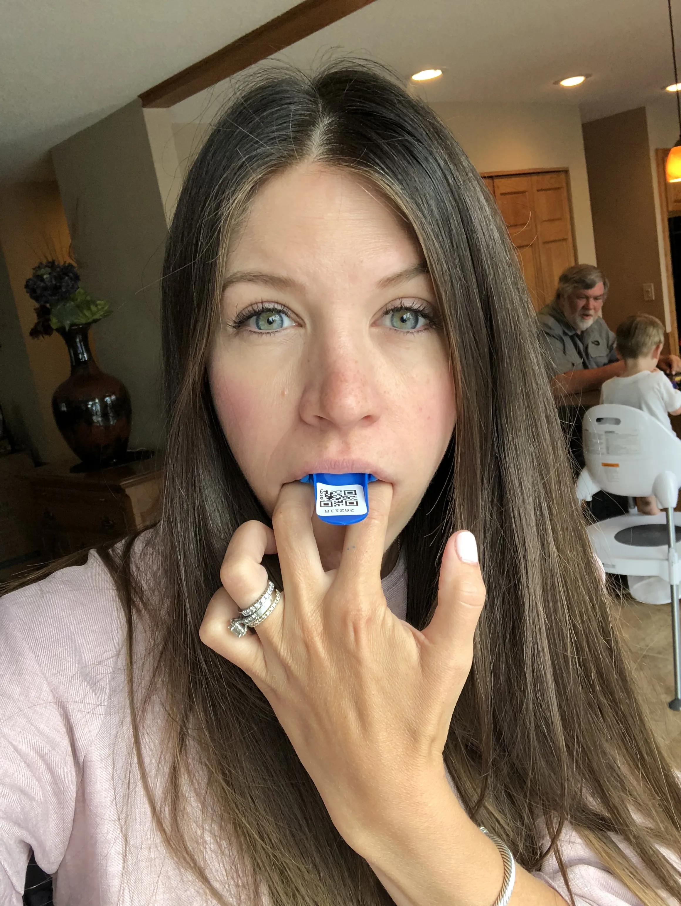 27878 fluoride treatment