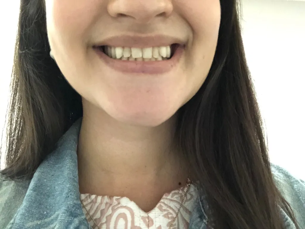 27878 gentle whitening