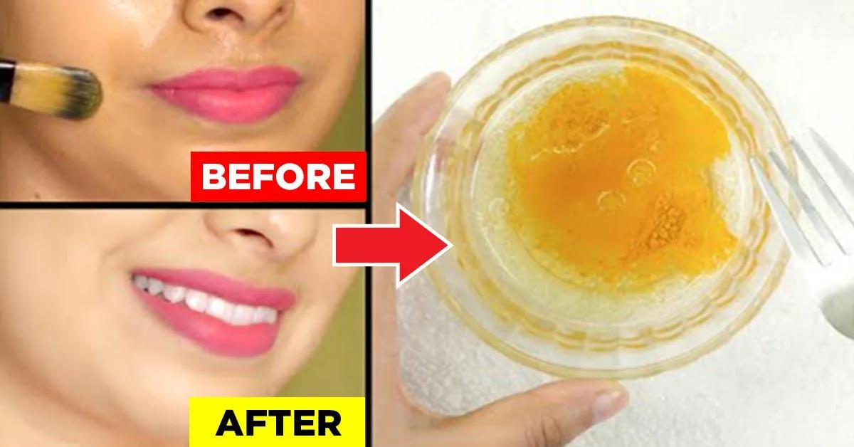 27880 sun exposure skin whitening