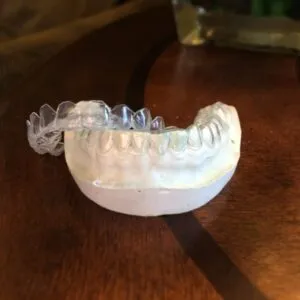 27893 teeth whitening mt pleasant sc at home