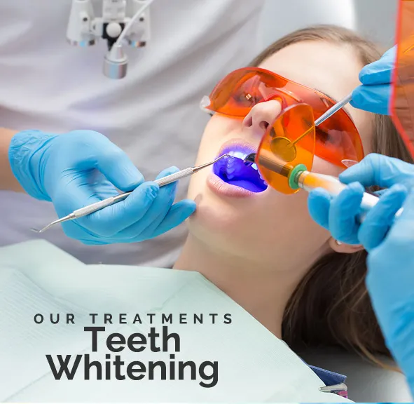 27894 teeth whitening procedure