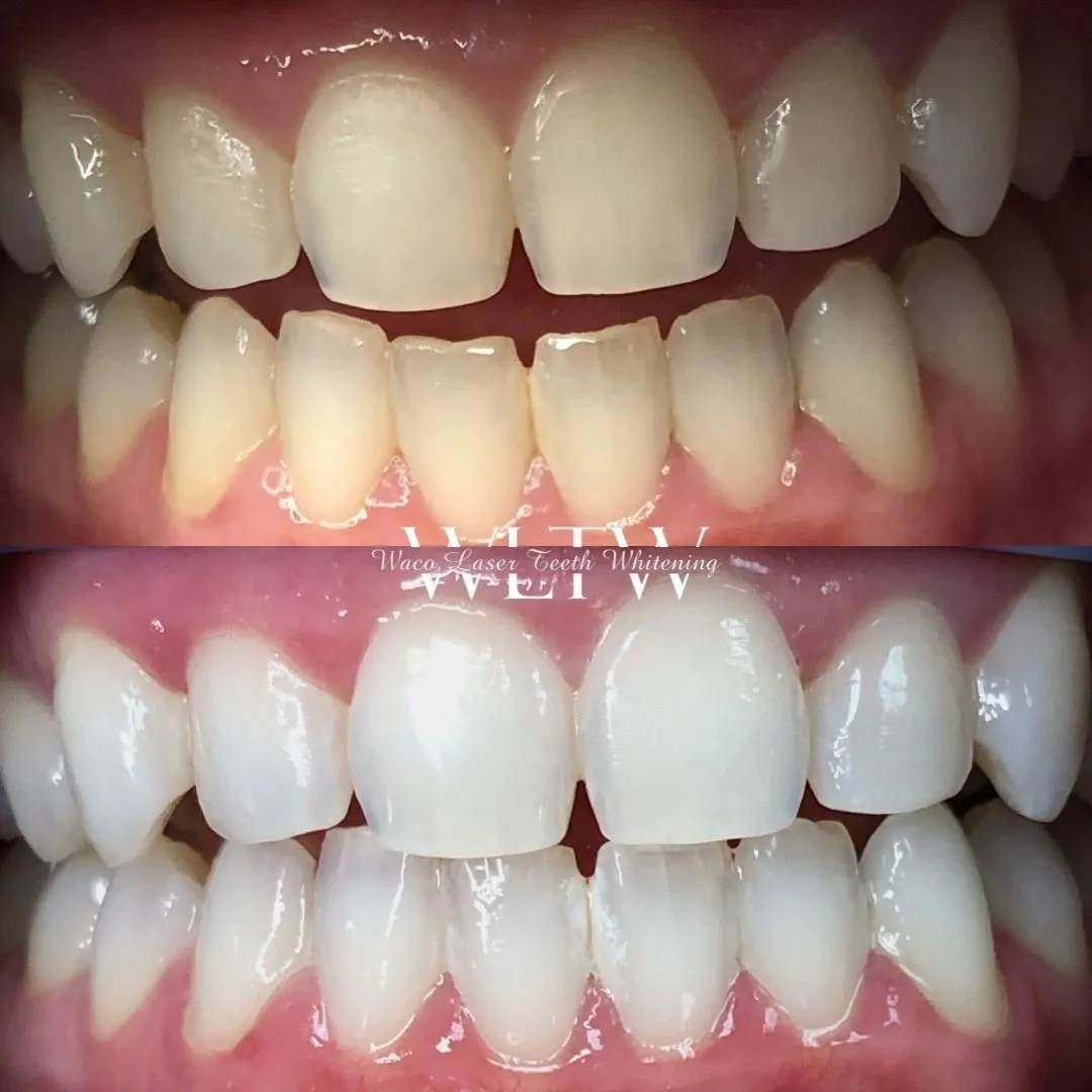 27899 teeth whitening georgetown tx main
