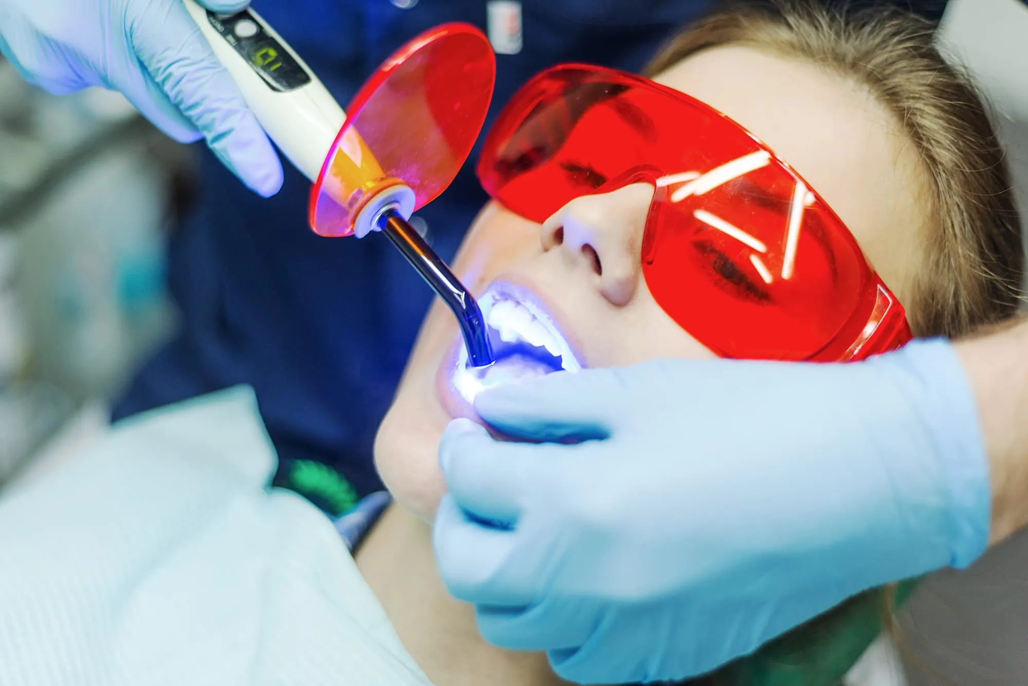 27899 teeth whitening georgetown tx treatment