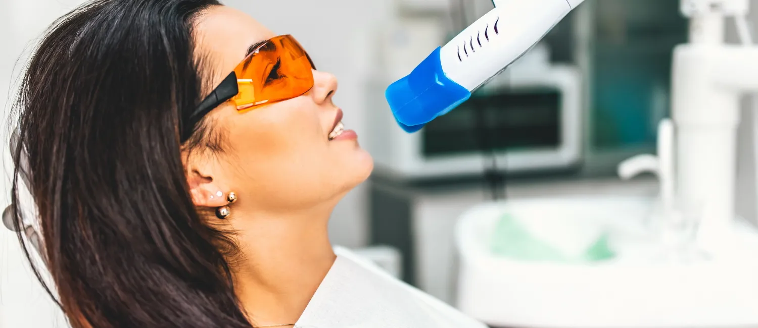 27903 in office whitening