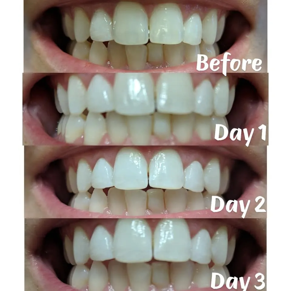 27904 teeth whitening science